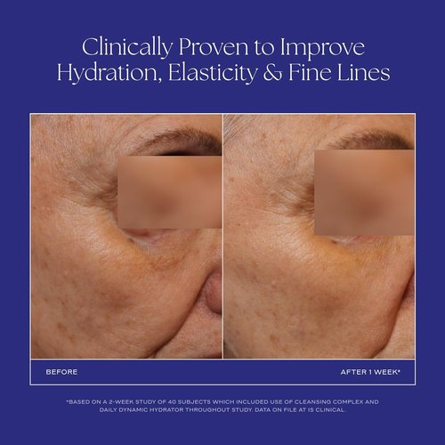 iS CLINICAL Daily Dynamic Hydrator - Hydrating Anti-Aging Face Moisturizer with Hyaluronic Acid | Repairs & Protects Skin