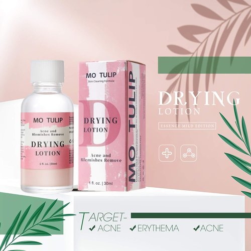 MO TULIP Acne Drying Lotion - Overnight Spot Treatment for Face & Body | 1 oz Pimple & Blemish Solution