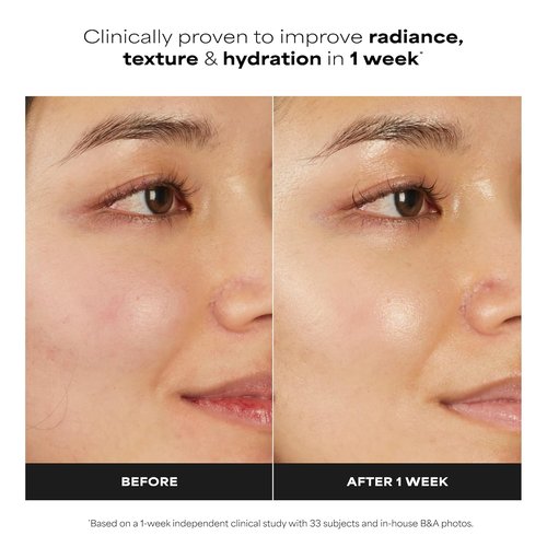 Paula's Choice Face Serum - 7% Ectoin & Hyaluronic Acid for Deep Hydration | 7-in-1 Barrier Repair, Dermatologist-Tested