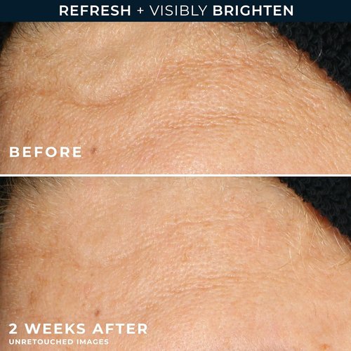 RoC Multi Correxion Revive + Glow Gel | Vitamin C Facial Cleanser with Glycolic Acid - 6 Ounces