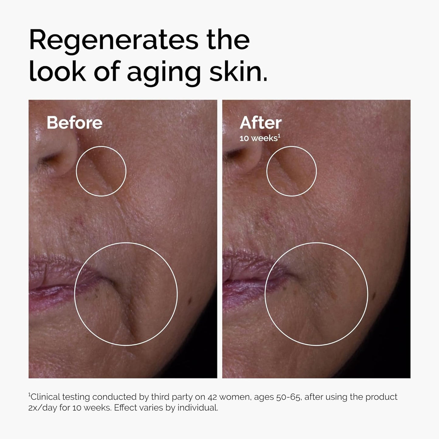 The Ordinary - GF 15% Anti-Aging Solution for Visible Skin & Wrinkle Repair | 1 Fl Oz