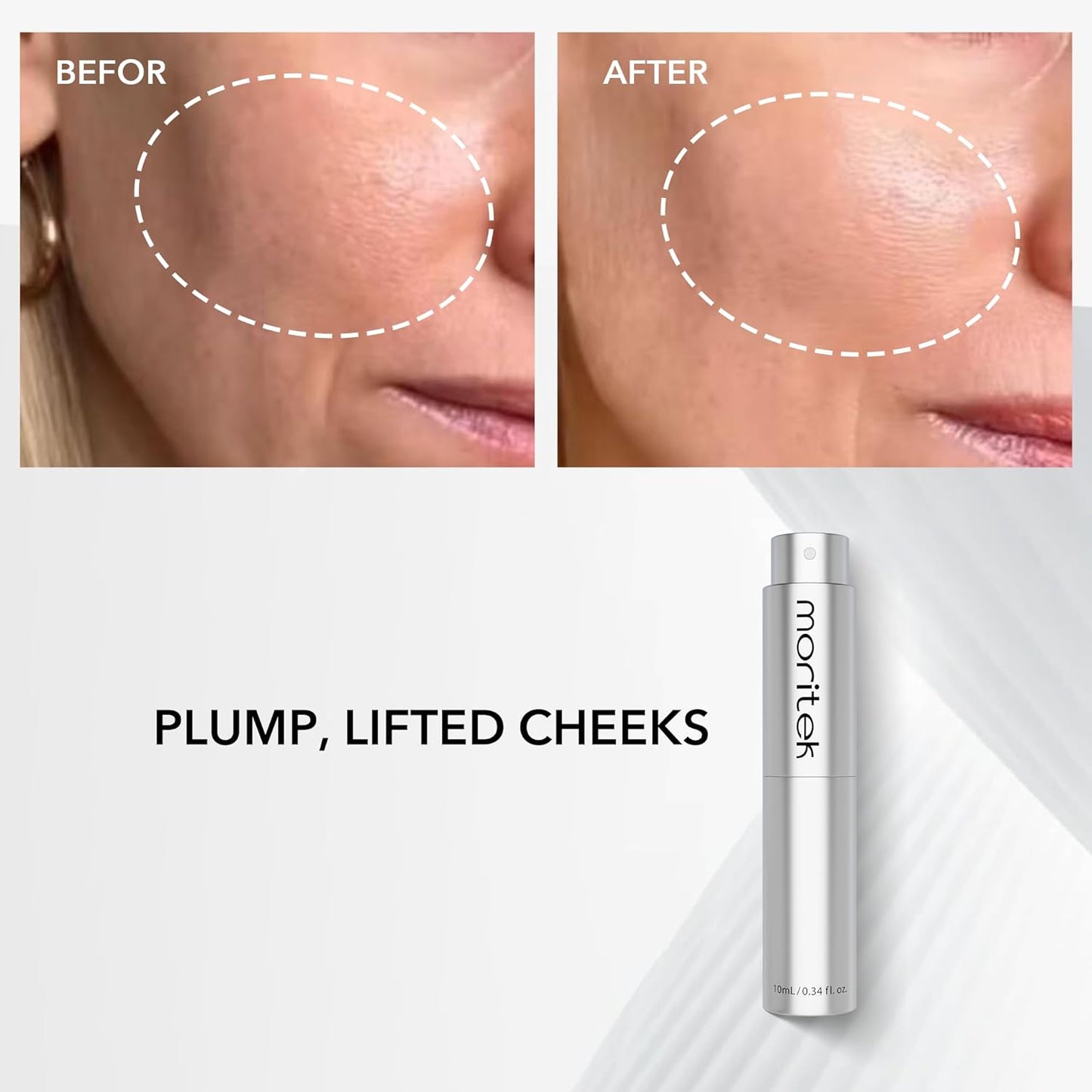Skiennix Anti-Wrinkle Essence Mist - Firm, Hydrate & Brighten Sensitive Skin | 10ml