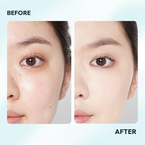 Vacure:treat Hydrating Toner for Face with Niacinamide, AHA BHA PHA, Arginine, Centella, Green Tea, Refines Pore Appearance, Balances Skin, All Skin Types, 4.9 Fl. Oz (145ml), 1 Count