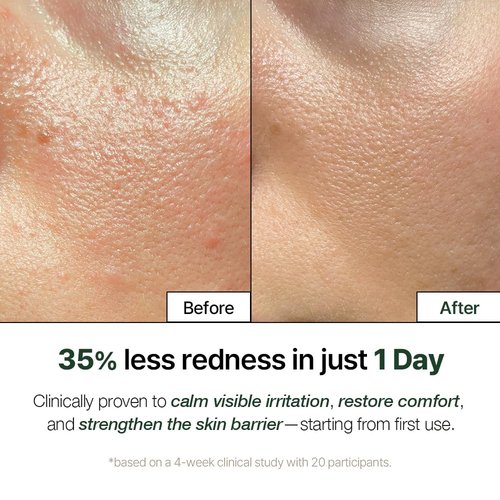 Natural Derma Project NDP Cica Cream - Lightweight Gel Face Moisturizer for Sunburn Relief | Hydrating & Soothing (1.7 Fl oz / 50ml)