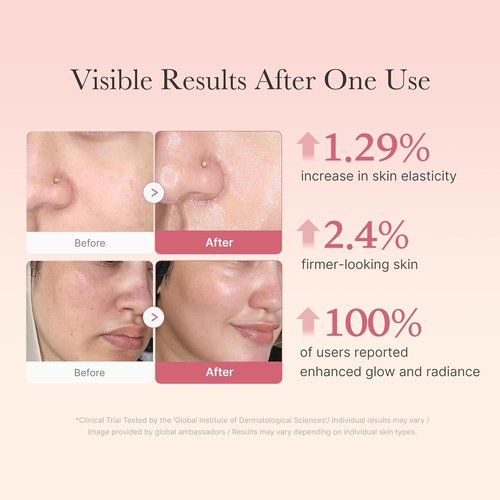 Medicube Collagen Swirl Duo - Glowing, Firmer Skin with 50ml Collagen Jelly Cream & Triple Collagen Cream | Niacinamide & Hyaluronic Acid