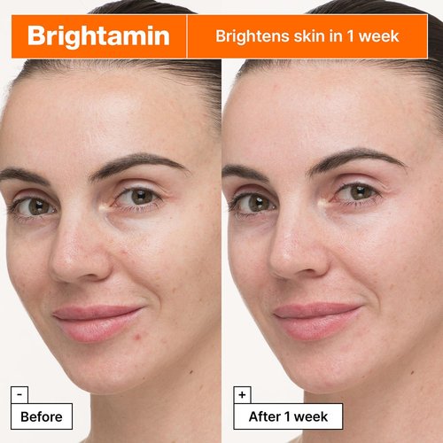 Dr.Jart+ Brightamin Brightening Serum - Vitamin C & Niacinamide for Fine Lines | Dark Spot Corrector, 0.27 Fl Oz