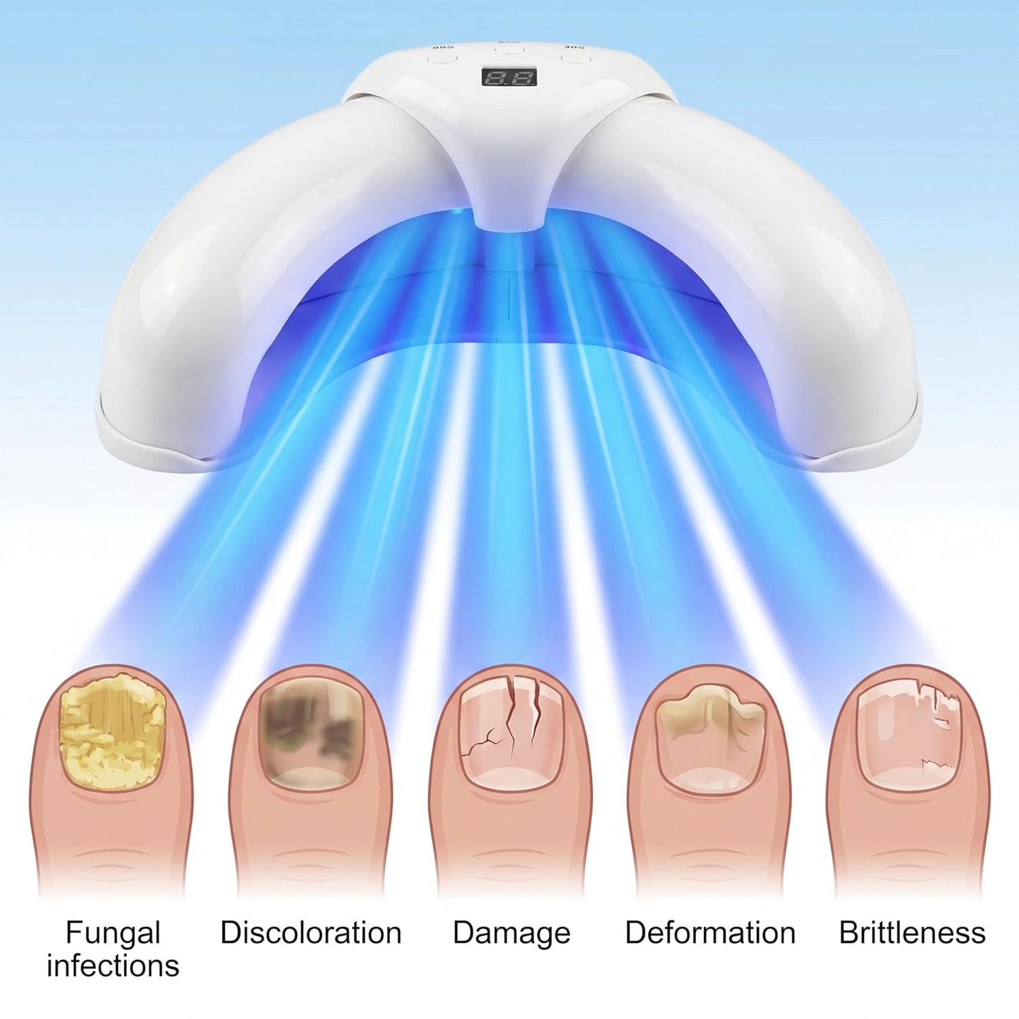 Skiennix 5-Finger Nail Fungus Treatment Device - Rechargeable LED Tool for Fingernails & Toenails