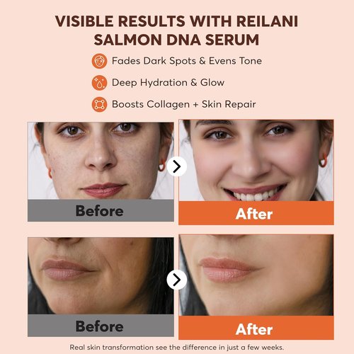 PDRN Salmon DNA Serum - Anti-Aging Hydrating Face Serum with Hyaluronic Acid & Vitamins | 1 Fl Oz