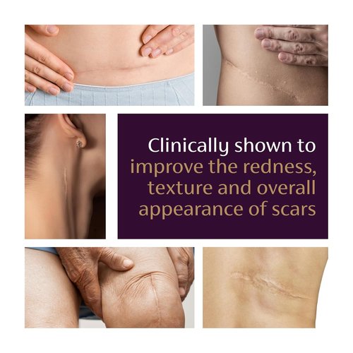 Mederma Advanced Scar Gel - Treats Old & New Scars, Reduces Appearance of Scars from Acne, Surgery, Burns, Injury & Stretch Marks, 0.70 Oz (20g)