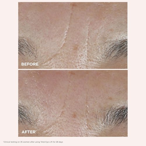 Clarins Total Eye Lift - Anti-Aging Eye Cream for Wrinkles, Dark Circles & Puffiness | Refillable