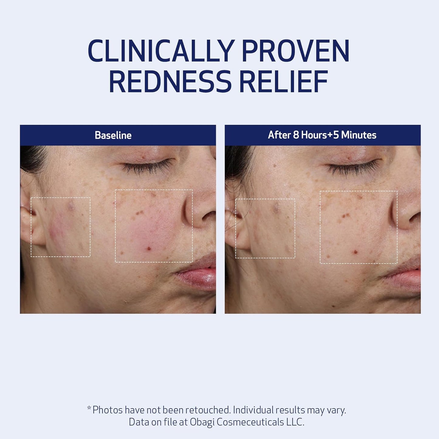 SUZANOBAGIMD Moisture Restore - Medical-Grade Multi-Layered Hydration for Redness Relief & Improved Skin Texture - 1.7 oz