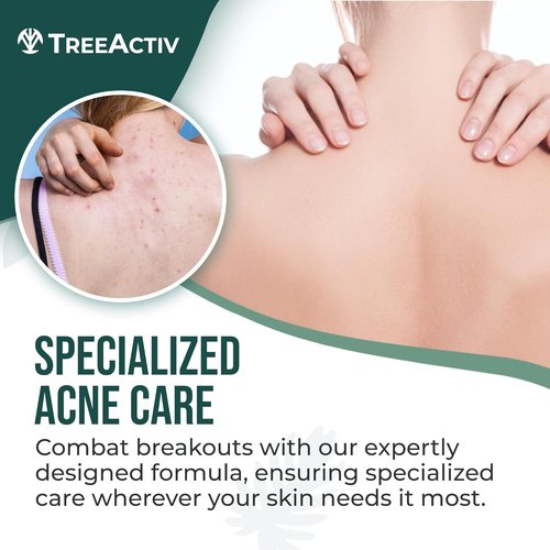 Back Acne Spray by [Brand Name] - 2% Salicylic Acid & Tea Tree Oil Mist for Fast Relief | 4 fl oz