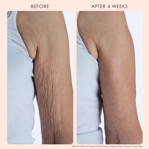 Crepe Erase Body Refining Exfoliant - Gently Removes Dry Skin & Smooths Texture | 8 Oz
