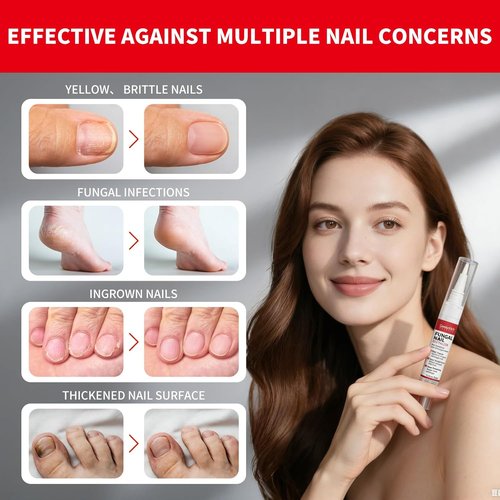 Regine Switzerland Toenail Fungus Treatment Pen - Extra Strength Nail Repair with Tea Tree Oil | 3-Pack for Discolored & Thick Nails