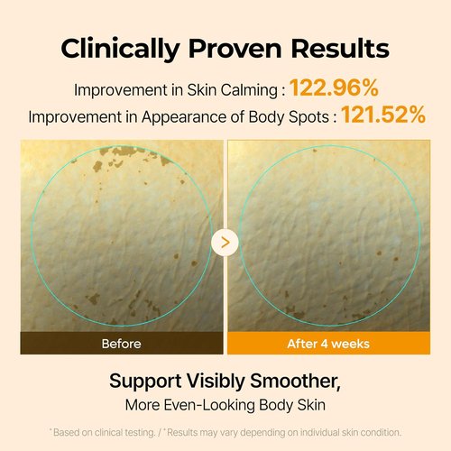 Dr. Melaxin Kojic Acid Body Cream - Brightening Moisturizer for Dark Spots & Uneven Tone | 7.05 oz