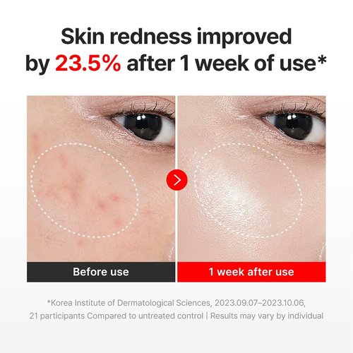 CENTELLIAN 24 Madeca Cream - Hydrating TECA Centella Asiatica Face Cream (1.69 fl oz) | Firming & Smoothing Skin
