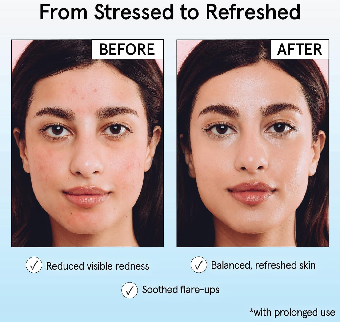 Grace & Stella Hypochlorous Acid Spray - Soothing Face Mist for Acne & Redness Relief | Travel Size (60 ml)