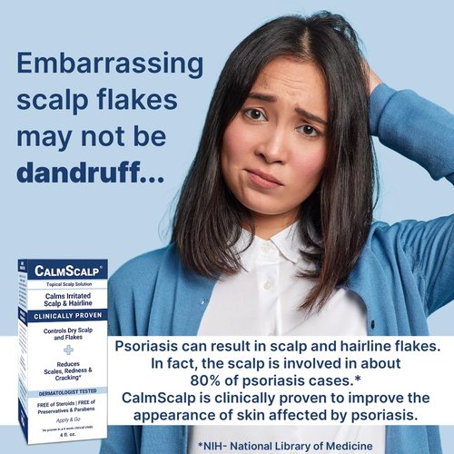 Scalp Treatment by [Brand Name] - Itch Relief & Exfoliation for Healthier Hair | 4 oz Made in USA