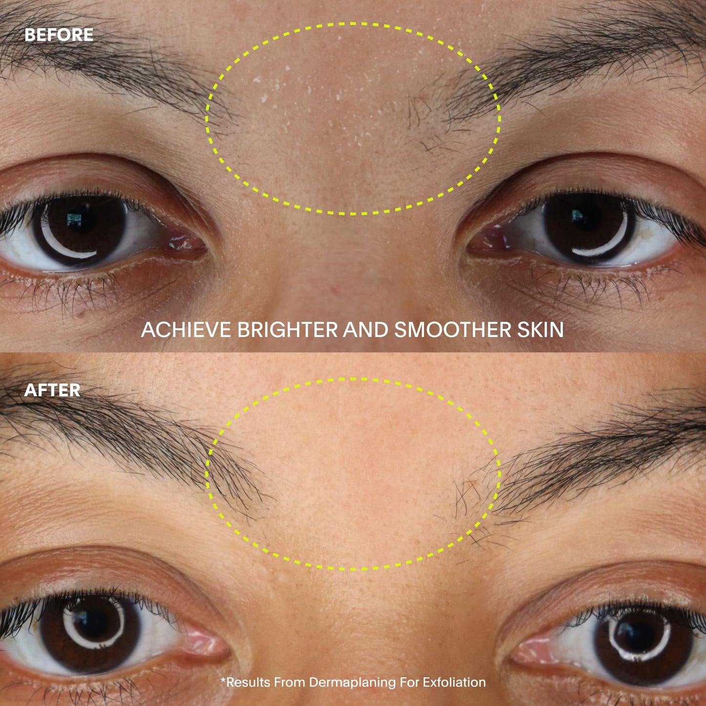 Leaf Shave | The Leaf Dermaplaner Kit, Silver - All-Metal Facial Razor and Exfoliating Tool for Women; Gift Set Includes 1x Dermaplaner, 1x Stand, & 12x Refills