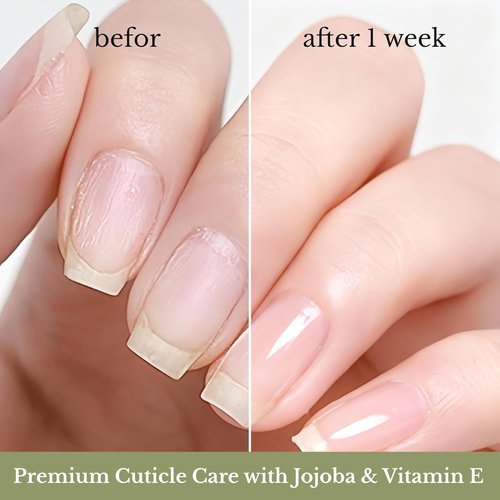 NOVAL Cuticle Oil Roll-On for Men & Women - Cedar Scented Nail Care Serum, Travel Size with Jojoba Oil