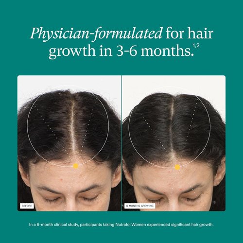 Nutrafol Women's Hair Growth Supplements - Clinically Proven for Thicker, Stronger Hair | 1 Month Supply