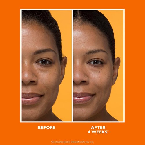 Peter Thomas Roth | Brightening Vitamin C Moisturizer - Potent-C™ Formula for Radiant Skin