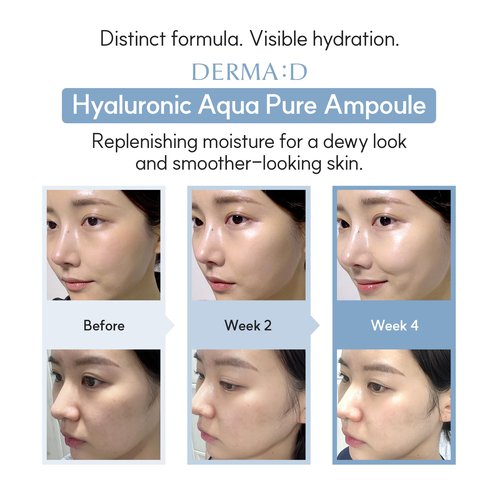 DERMA:D Korean Ampoule Hyaluronic Acid Serum – Deep Hydration & Multi-Benefit Formula with Panthenol, Vitamin C, Retinol – Moisturizing Face Serum for Radiant, Even Complexion – 1.69 fl oz