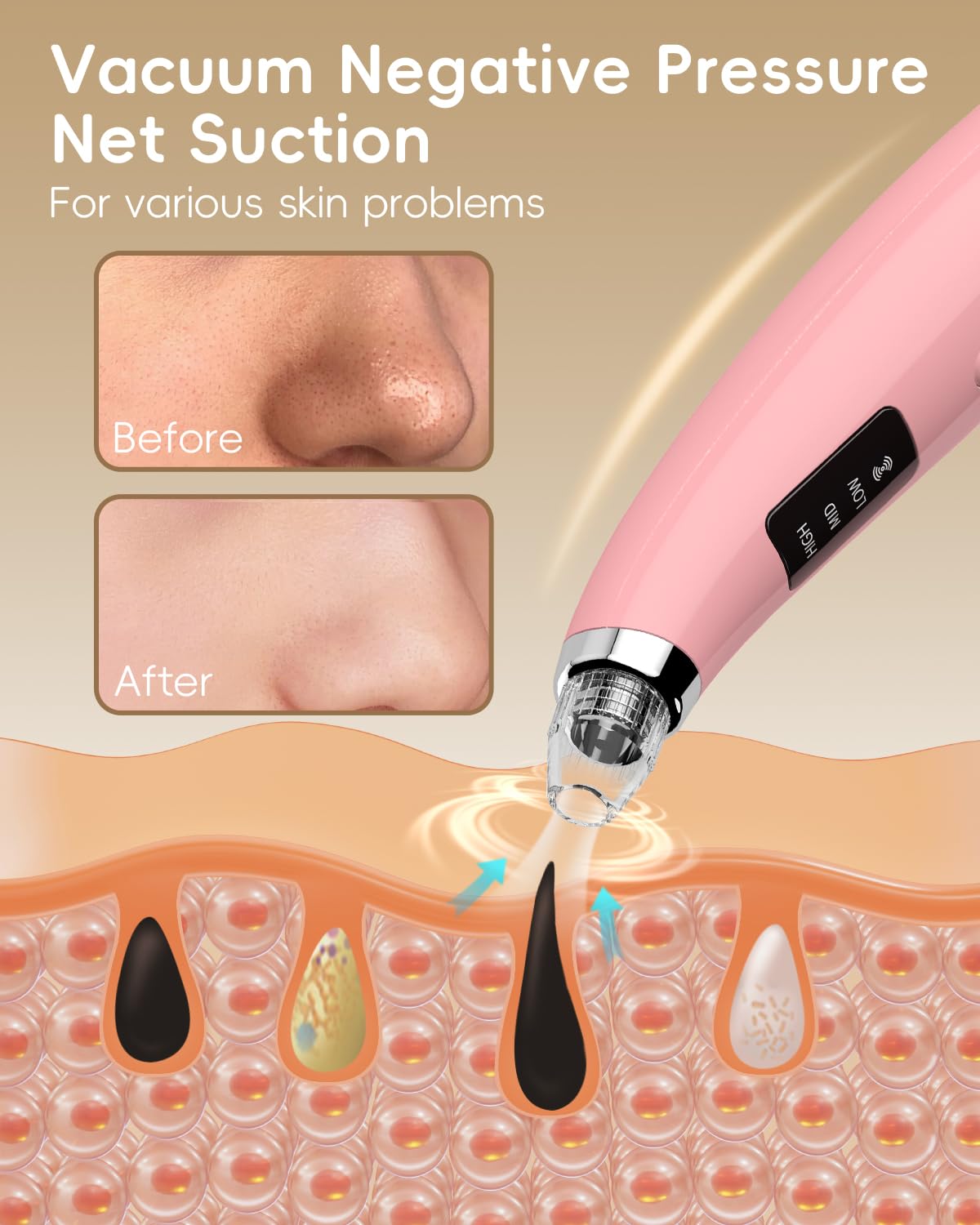 Facial Pore Blackhead Remover Vacuum - Face Cleaner and Blackhead Extractor with 3 Adjustable Suction Levels, 5 Probes, USB Charging Interface - Pore Vacuum Kit for Women&Men (Pink)