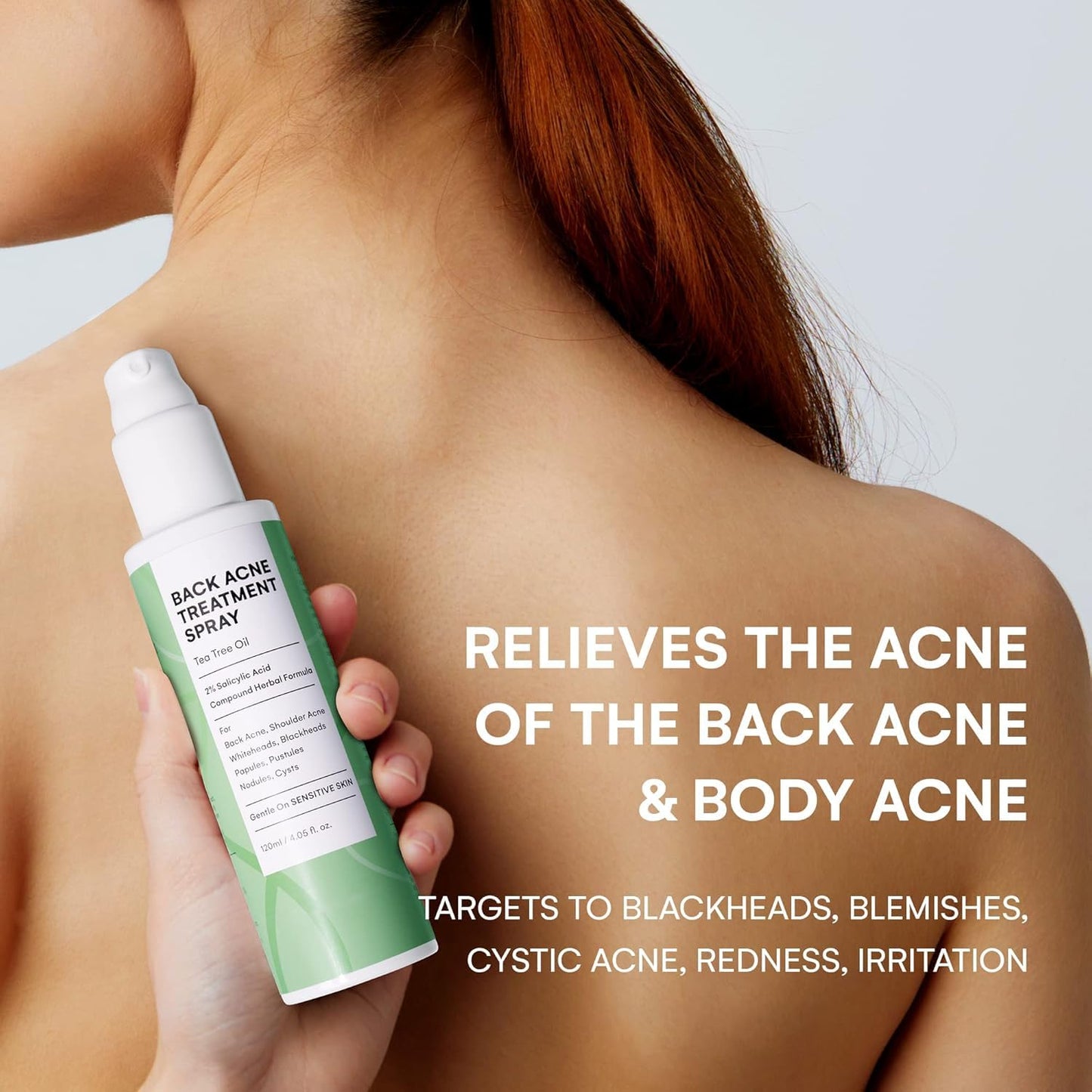 CIZ Back Acne Treatment Spray: Body Acne Treatment with 2% Salicylic Acid and Tea Tree Oil, Herbal Formula Acne Treatment For Teens, Back Acne Solution, 4.05 Ounce
