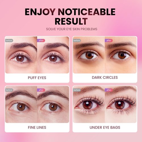 AILEORY Under Eye Patches (24 Pairs) - New Tri-color Glitter Eye Gel Pads for Dark Circles Puffy Eyes,Under eye Bags,Wrinkles|Natural Collagen Under Eye Mask Patches, Gel Under Eye Patches