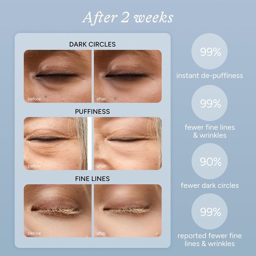 Regine Switzerland Caffeine & Hyaluronic Acid Under Eye Patches - 5 Pairs for Dark Circles & Puffiness