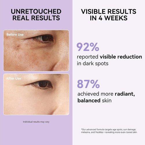 Regine Switzerland Dark Spot Remover Serum - Evens Skin Tone for Face & Body | 1.7 Fl Oz