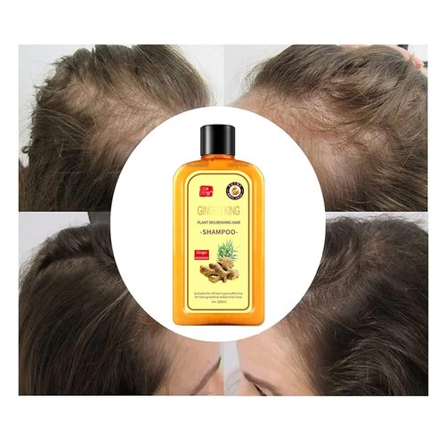 Ginaday Instant Ginger Hair Regrowth Shampoo - Anti-Hair Loss Formula for Thicker Hair | 9.47 FL. Oz (280 ML)