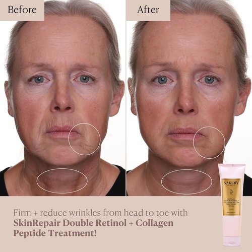 Nakery Beauty Retinol Cream - Anti-Aging Moisturizer with Collagen & Hyaluronic Acid | All Skin Types, Day & Night Use