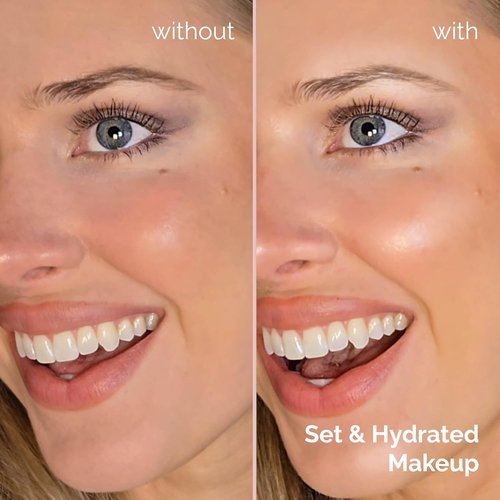 Elizabeth Mott Thank Me Later 3-in-1 Dewy Makeup Setting Spray - Hydrating Fine Mist with Niacinamide for Radiant Skin - Lightweight, Oil-Free, 95 mL