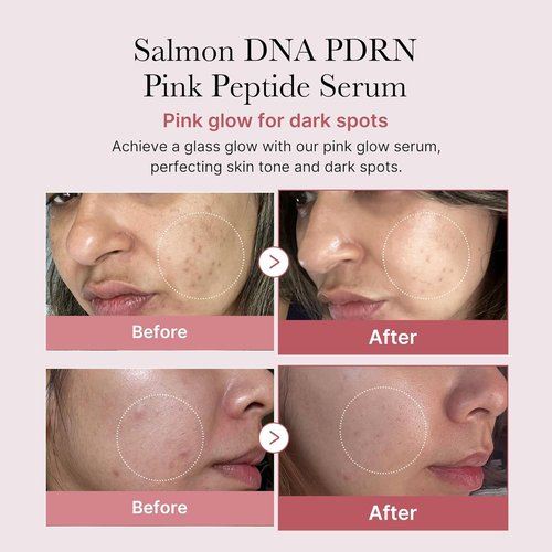 Medicube PDRN Peptide Serum Duo - Radiant Face & Eye Care Set | Salmon DNA & Eye Serum for Plump Skin