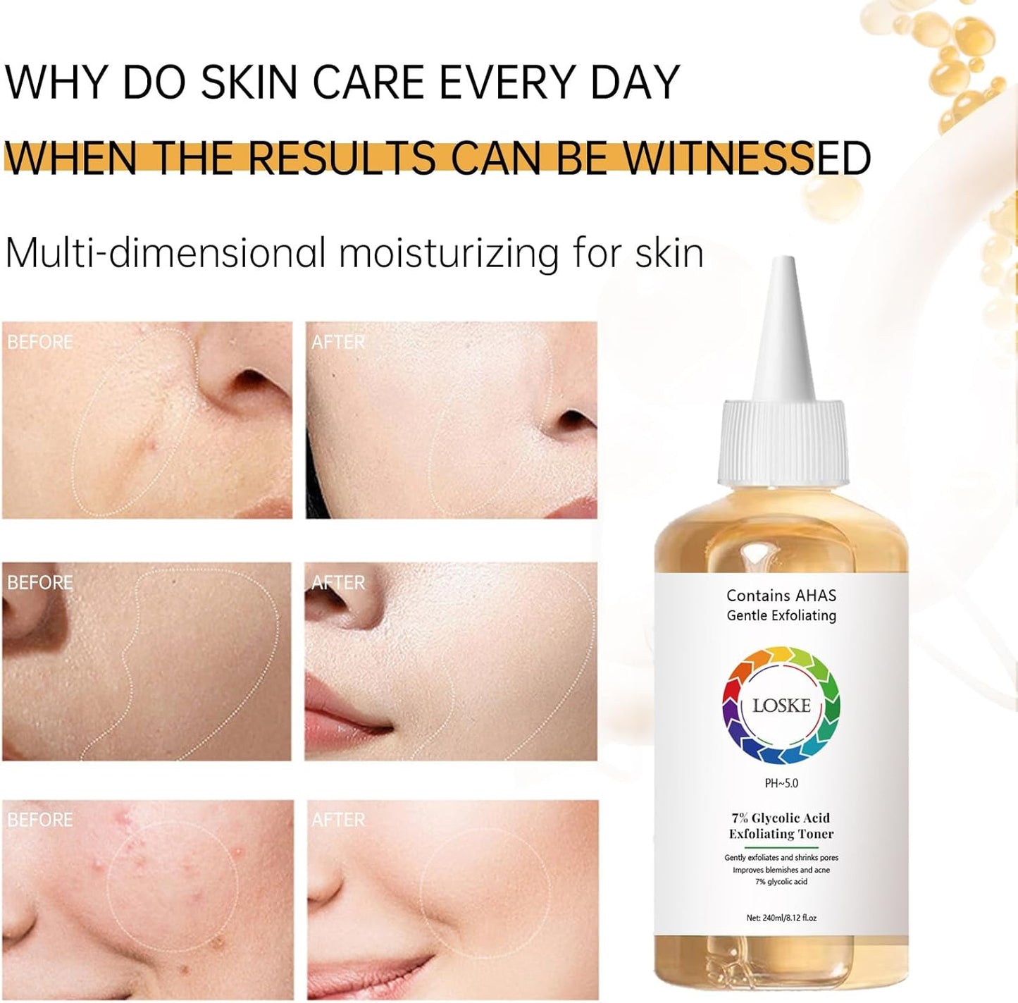 Skiennix 7% Glycolic Acid Face Toner - Exfoliating Formula for Clear Skin & Radiant Complexion