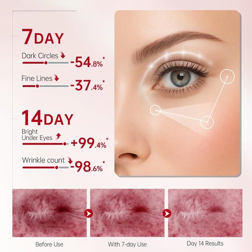 Peunitory Eye Balm Stick - Anti-Wrinkle Firming Treatment | Dark Circle Brightener | Hydrating 0.32oz