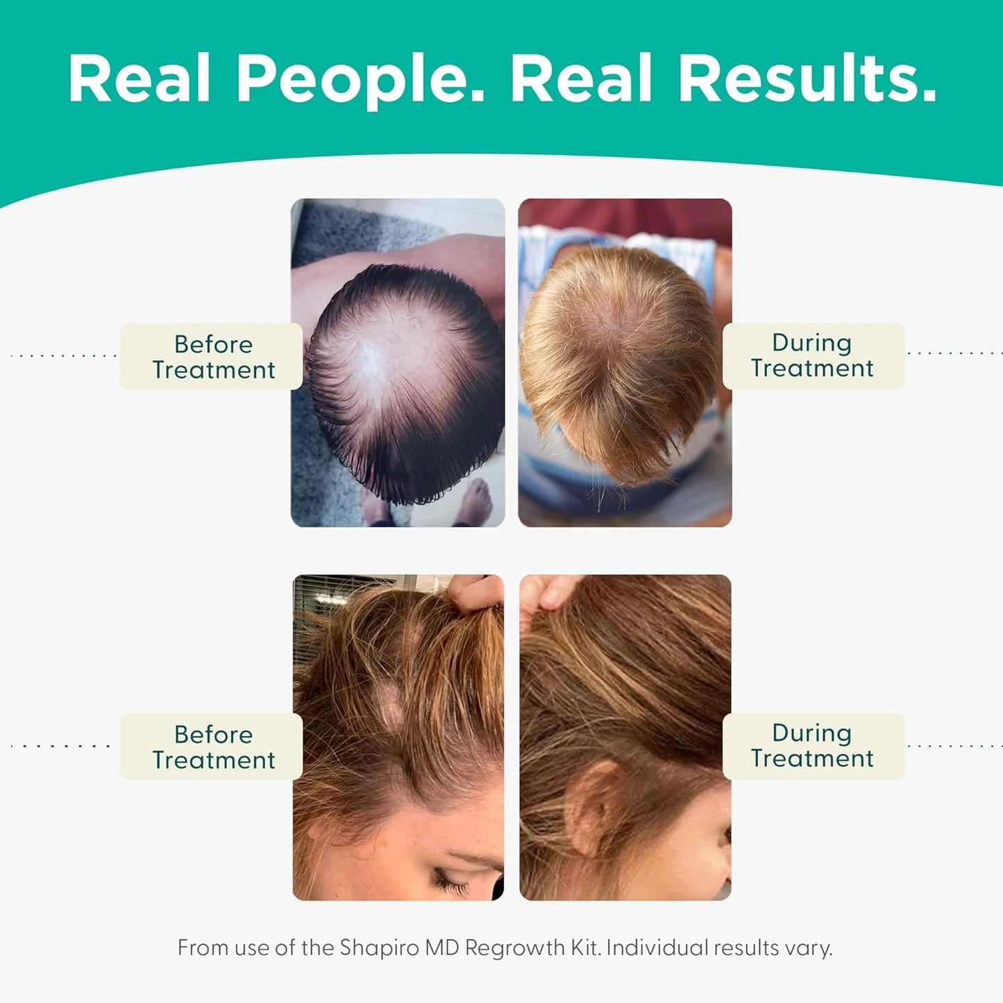 Shapiro MD Hair Growth Shampoo & Conditioner - DHT Fighting Vegan Formula for Thinning Hair