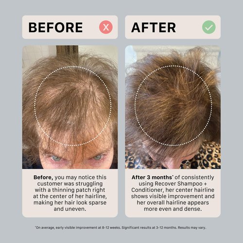 ACTIIV Recover Thickening Conditioner - Strengthens & Hydrates for Thicker, Fuller Hair | Plant-Based, Color-Safe, Unisex