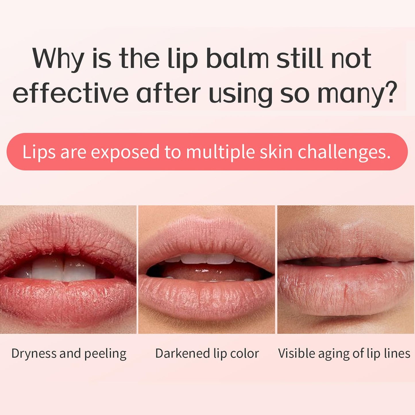 Skiennix Lip Sleeping Mask - Hydrating Overnight Repair for Dry, Chapped Lips | Vegan & Cruelty-Free