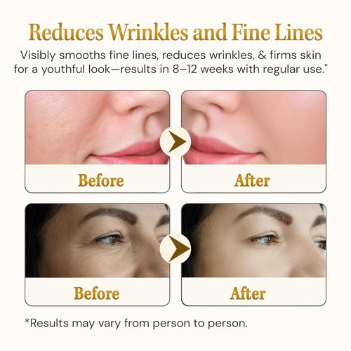 Matrixyl 3000 Anti-Aging Serum - Deep Wrinkle Repair with Hyaluronic Acid & Peptide Collagen | 1.01 Fl Oz