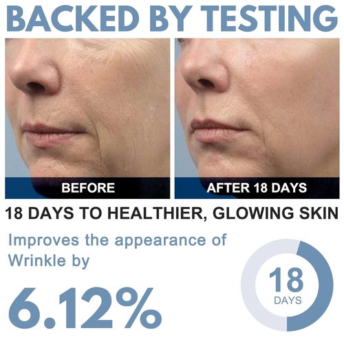 Ribose Cream - Anti-Aging Moisturizer with D-Ribose & Coconut Oil | Tightens & Firms Skin, 2.5 oz