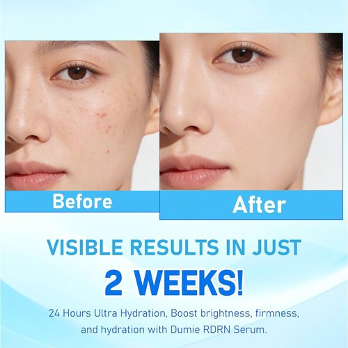 DNA PDRN Wrinkle-Reducing Serum - with 5000ppm Salmon DNA, 2000ppm Collagen, Glutathione, Niacinamide & 6 Hyaluronic Acids, 30Count (1)