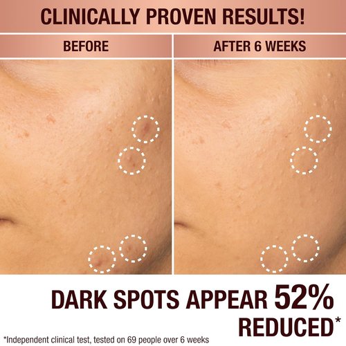 Charlotte Tilbury Radiance Recovery Serum - Tranexamic Acid & Vitamin C for Brighter Under Eyes | Reduces Dark Spots & Redness