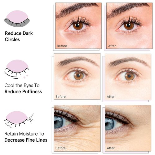 Grace & Stella Under Eye Mask Variety Pack - 18 Pairs of Gel Patches for Dark Circles - 6 Colors, Vegan