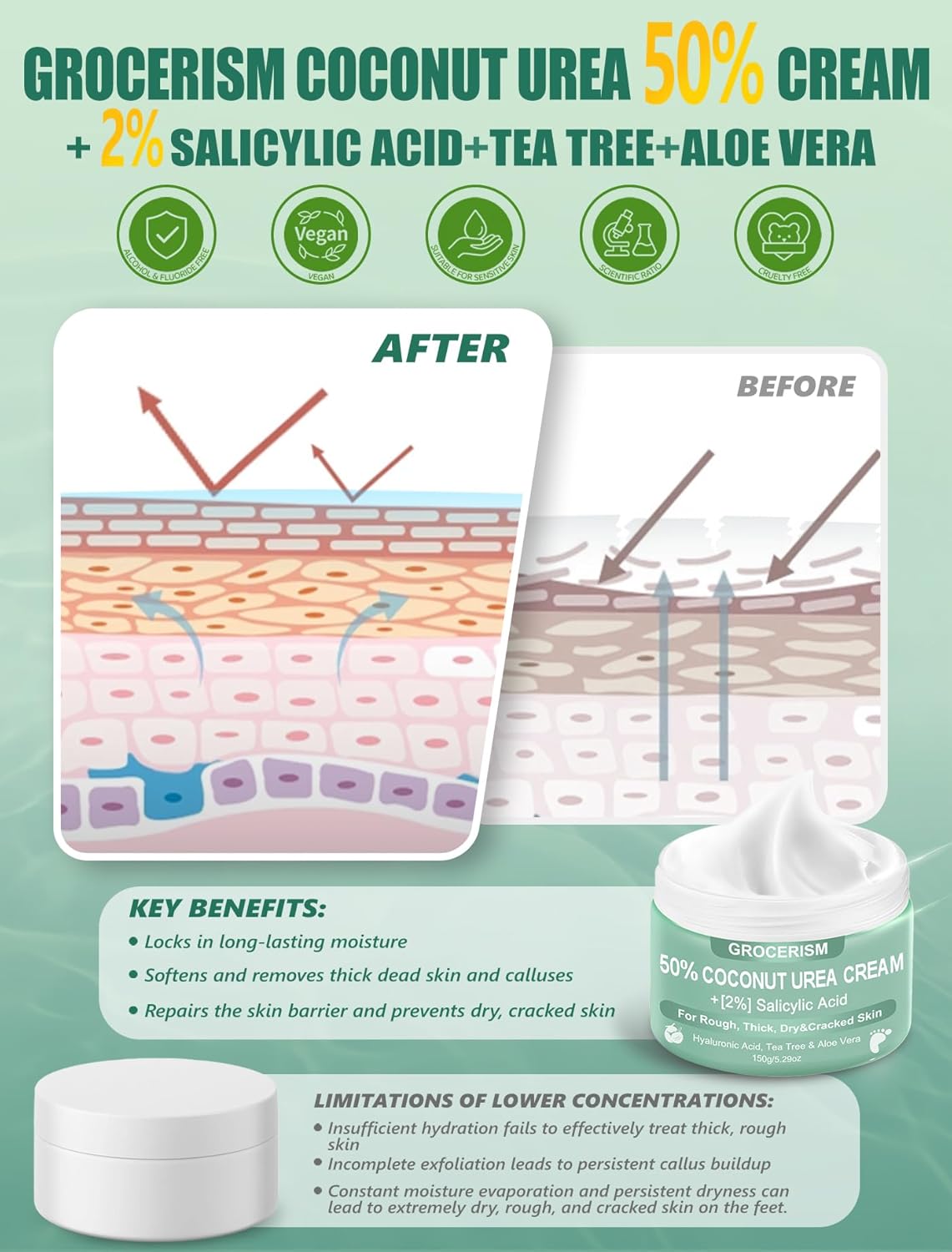 Urea Cream 50% for Feet - Maximum Strength Foot & Hand Cream with Salicylic Acid, Tea Tree & Aloe Vera | 5.29 oz