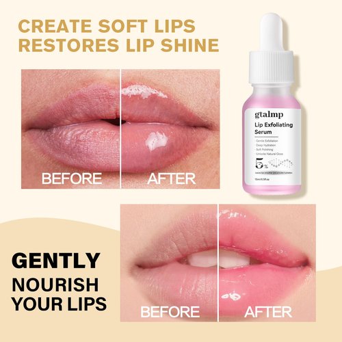 gtalmp PHA 5% Exfoliating Lip Serum - Gentle Overnight Treatment for Dry, Flaky Lips, Hydrating Lip Exfoliator & Primer for Smoother, Softer & Plump-Looking Lips (1)