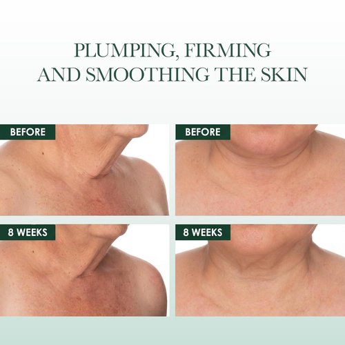 RéVive Fermitif Neck Renewal Cream - Anti-Aging Neck & Décolletage Tightening Cream with SPF 15 - 2.5 OZ