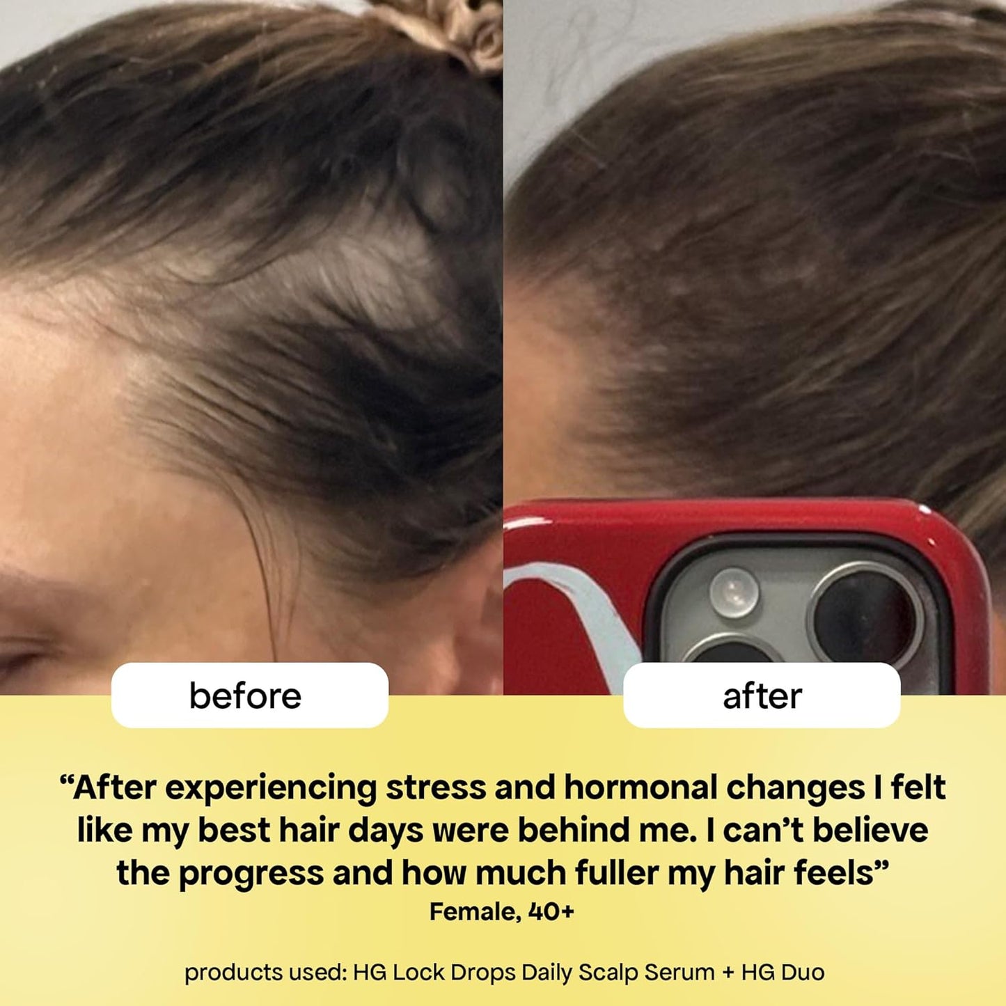 BondiBoost Hair Growth Lock Drops Serum - Non-Greasy Formula for Thicker, Fuller Hair | Vegan & Color-Safe